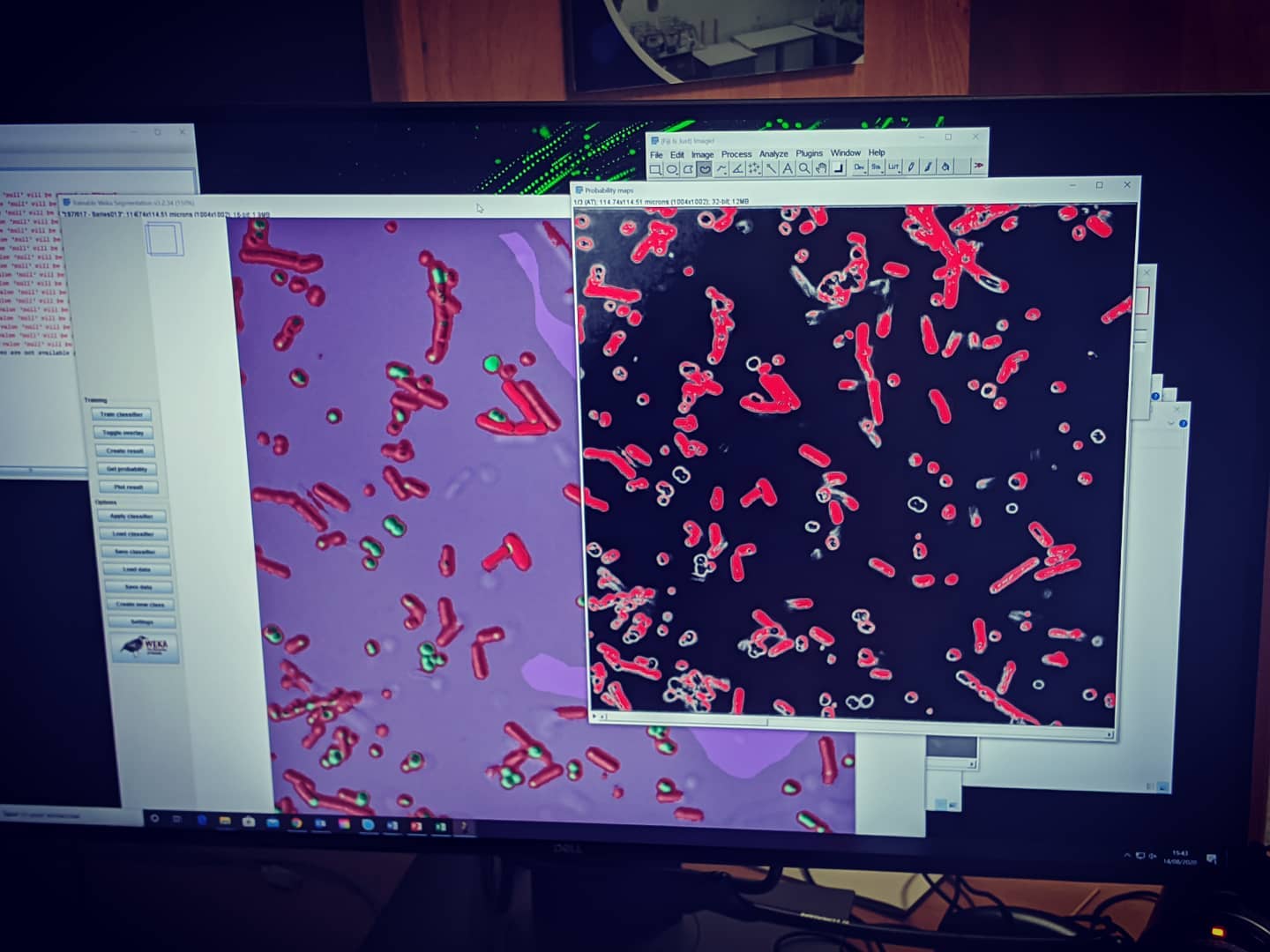 Microscope bacteria analysis