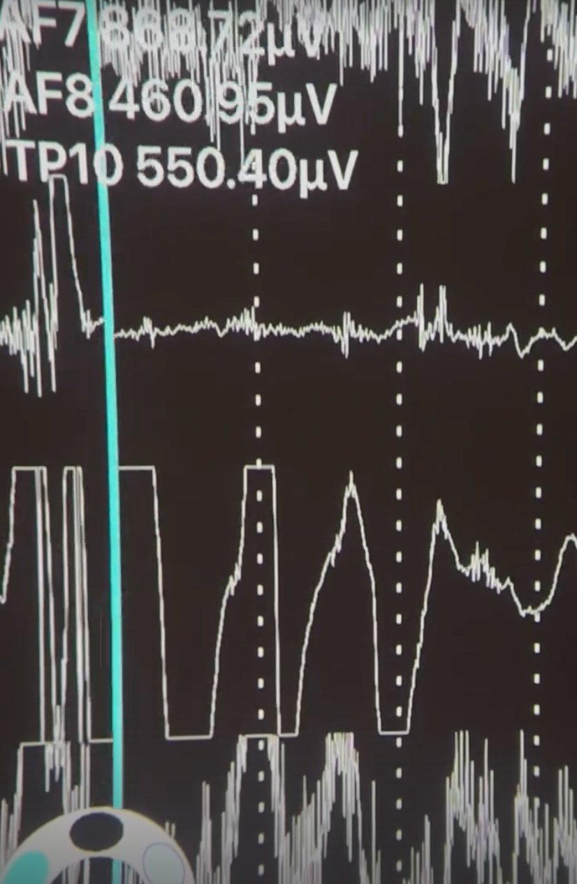 Brainwave data visualization